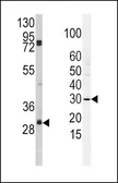 Anti-SLUG antibody, N-term used in Western Blot (WB). GTX82511