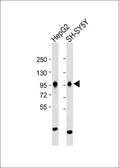 Anti-PROX1 antibody, Internal used in Western Blot (WB). GTX82515