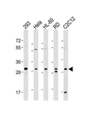 Anti-EIF4E2 antibody used in Western Blot (WB). GTX82524