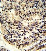 Anti-Bcl2A1 antibody, Internal used in IHC (Paraffin sections) (IHC-P). GTX82541