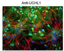 Anti-PGP9.5 antibody used in Immunocytochemistry/ Immunofluorescence (ICC/IF). GTX82567