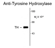 Anti-Tyrosine Hydroxylase antibody used in Western Blot (WB). GTX82571
