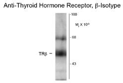 Anti-Thyroid Hormone Receptor beta antibody [2386] used in Western Blot (WB). GTX82578