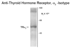 Anti-Thyroid Hormone Receptor alpha antibody [1330] used in Western Blot (WB). GTX82579