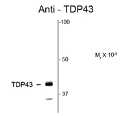 Anti-TDP43 antibody used in Western Blot (WB). GTX82580