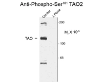 Anti-TAOK2 (phospho Ser181) antibody used in Western Blot (WB). GTX82581