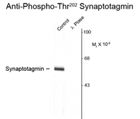 Anti-Synaptotagmin 1 (phospho Thr202) + Synaptotagmin 2 (phospho Thr199) antibody used in Western Blot (WB). GTX82584