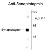 Anti-Synaptotagmin 1 antibody used in Western Blot (WB). GTX82585