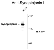 Anti-Synaptojanin 1 antibody [5H1] used in Western Blot (WB). GTX82587