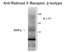 Anti-Retinoid X Receptor beta antibody [147] used in Western Blot (WB). GTX82600