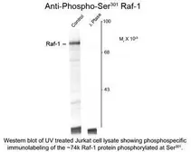 Anti-Raf1 (phospho Ser301) antibody used in Western Blot (WB). GTX82602