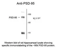 Anti-PSD95 antibody used in Western Blot (WB). GTX82606