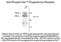 Anti-Progesterone Receptor (phospho Ser190) antibody [1154] used in  (). GTX82608