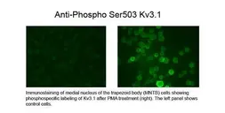 Anti-Kv3.1 (phospho Ser503) antibody used in  (). GTX82609