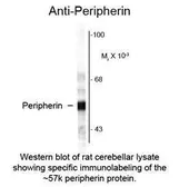 Anti-Peripherin antibody used in  (). GTX82613