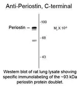 Anti-Periostin antibody, C-Term used in  (). GTX82616