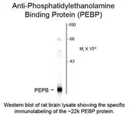 Anti-RKIP antibody used in Western Blot (WB). GTX82617