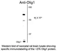 Anti-OLIG1 antibody used in  (). GTX82621
