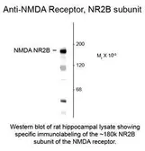 Anti-NMDAR2B antibody, N-Term used in  (). GTX82630