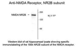 Anti-NMDAR2B antibody used in  (). GTX82632