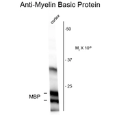 Anti-Myelin basic protein antibody used in Western Blot (WB). GTX82648