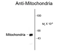 Anti-Mitochondria antibody [113-1] used in Western Blot (WB). GTX82650