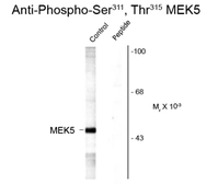 Anti-MEK5 (phospho Ser311/Thr315) antibody used in Western Blot (WB). GTX82655