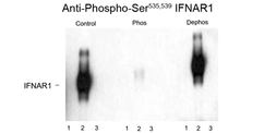 Anti-IFNAR1 (phospho Ser535/Ser539) antibody used in Western Blot (WB). GTX82662