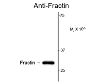 Anti-Fractin antibody used in Western Blot (WB). GTX82694
