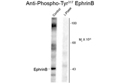 Anti-Ephrin B1 (phospho Tyr329) antibody used in Western Blot (WB). GTX82699