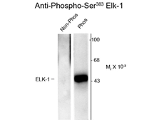 Anti-ELK1 (phospho Ser383) antibody used in Western Blot (WB). GTX82701