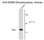 Anti-DOPA Decarboxylase antibody used in Western Blot (WB). GTX82709