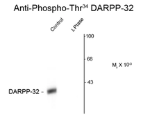 Anti-DARPP-32 (phospho Thr34) antibody used in Western Blot (WB). GTX82714