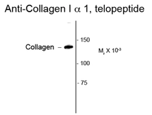 Anti-COL1A1 antibody used in Western Blot (WB). GTX82720