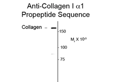 Anti-COL1A1 antibody used in Western Blot (WB). GTX82721