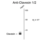 Anti-Clavesin antibody used in Western Blot (WB). GTX82723
