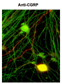 Anti-CGRP antibody [4901] used in Immunocytochemistry/ Immunofluorescence (ICC/IF). GTX82726