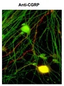 Anti-CGRP antibody [4901] used in Immunocytochemistry/ Immunofluorescence (ICC/IF). GTX82726