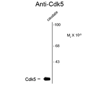 Anti-CDK5 antibody [1H3] used in Western Blot (WB). GTX82727