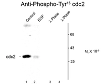 Anti-CDC2 (phospho Tyr15) antibody used in Western Blot (WB). GTX82728
