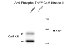 Anti-CaMKII alpha (phospho Thr286) antibody used in Western Blot (WB). GTX82730