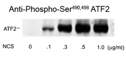 Anti-ATF2 (phospho Ser490/498) antibody used in Western Blot (WB). GTX82733