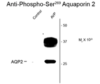 Anti-Aquaporin 2 (phospho Ser 269) antibody used in Western Blot (WB). GTX82734