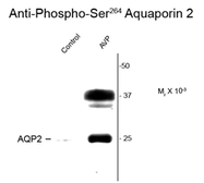 Anti-Aquaporin 2 (phospho Ser264) antibody used in Western Blot (WB). GTX82735