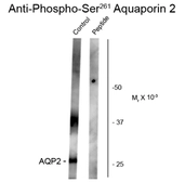 Anti-Aquaporin 2 (phospho Ser261) antibody used in Western Blot (WB). GTX82736