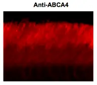 Anti-ABCA4 (Rim Protein) antibody [3F4] used in Immunohistochemistry (IHC). GTX82741