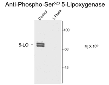 Anti-5-Lipoxygenase (phospho Ser523) antibody used in Western Blot (WB). GTX82744