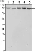 Anti-STAT3 antibody [3B5] used in Western Blot (WB). GTX82752