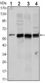 Anti-AKT1 antibody [3A3] used in Western Blot (WB). GTX82762