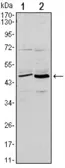 Anti-CD86 antibody [1B3] used in Western Blot (WB). GTX82769